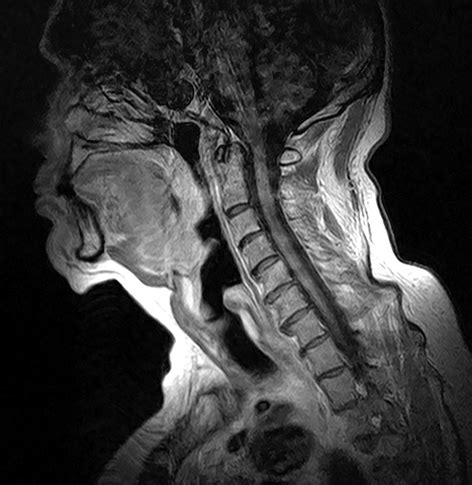 testing soft tissue of the neck|soft tissue scan for neck.